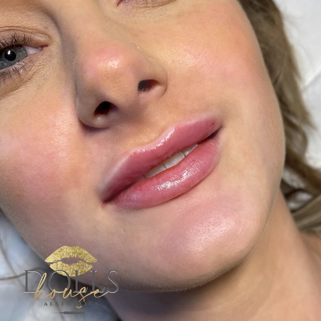 Lips