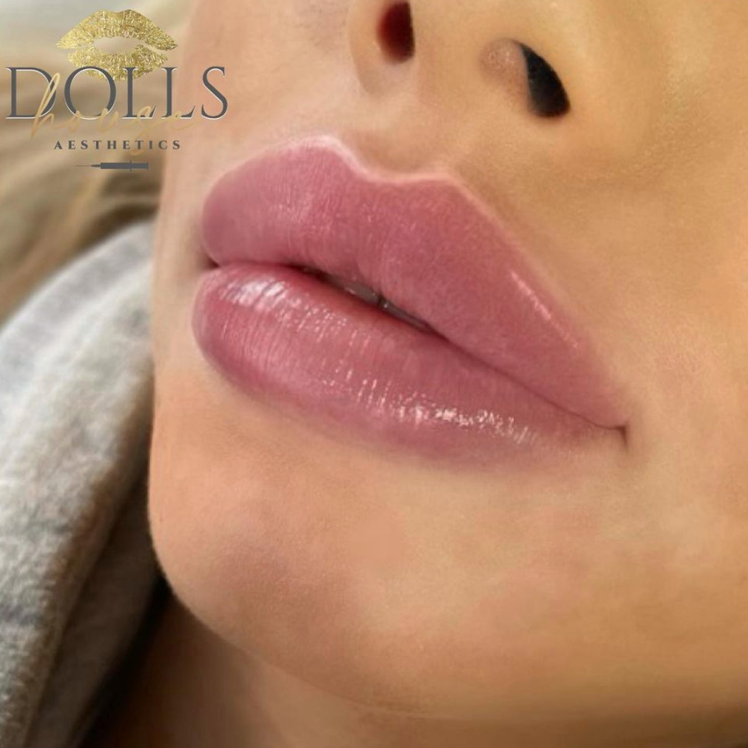 Lips